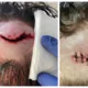 Images of the injuries inflicted by Louie McKillop on another man at The College Arms, Peterborough, last Christmas Eve